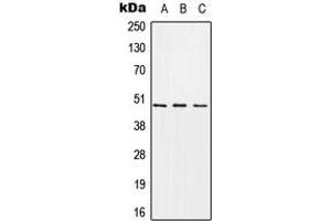 Western blot analysis of CHST1 expression in A549 (A), Raw264. (CHST1 抗体  (Center))