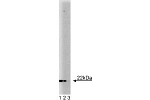 Western blot analysis of Ninjurin on HepG2 lysate. (NINJ1 抗体  (AA 1-152))