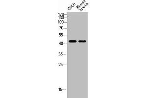 Western Blot analysis of MOUSE-BRAIN COLO cells using NK-1R Polyclonal Antibody (TACR1 抗体  (Internal Region))