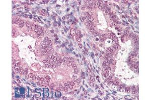 Immunohistochemistry (IHC) image for anti-CTD (Carboxy-terminal Domain, RNA Polymerase II, Polypeptide A) Small Phosphatase 1 (CTDSP1) (Internal Region) antibody (ABIN190811)