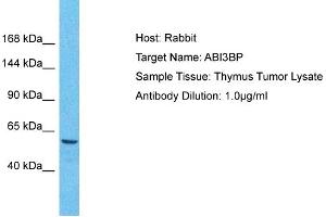 Host: Rabbit Target Name: ABI3BP Sample Tissue: Human Thymus Tumor Antibody Dilution: 1ug/ml (ABI3BP 抗体  (C-Term))