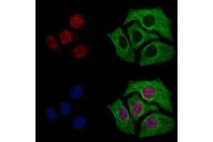 ABIN7094786 and ABIN7098837 staining Hela cells by IF/ICC.