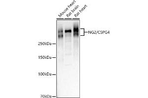 Western blot analysis of extracts of various cell lines, using NG2/CSPG4 antibody (ABIN1679389, ABIN3017852, ABIN3017853 and ABIN5664347) at 1:1000 dilution. (NG2 抗体  (AA 1950-2210))