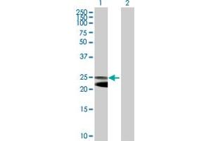Western Blot analysis of NFAM1 expression in transfected 293T cell line by NFAM1 MaxPab polyclonal antibody. (NFAM1 抗体  (AA 1-270))