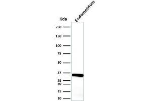 Western Blot Analysis of endometrium using Calponin-1 Mouse Monoclonal Antibody (CALP). (CNN1 抗体)