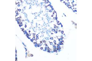 Immunohistochemistry of paraffin-embedded mouse testis using Lamin B1 Rabbit mAb (ABIN7268180) at dilution of 1:100 (40x lens). (Lamin B1 抗体)