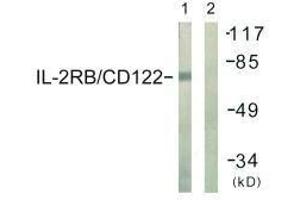 Western blot analysis of extracts from COS7 cells, using IL-2Rβ/CD122 (Ab-364) antibody. (IL2 Receptor beta 抗体  (Tyr364))