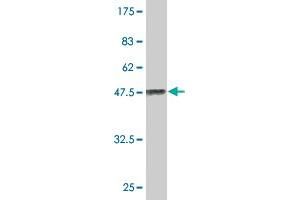 Western Blot detection against Immunogen (41. (MED21 抗体  (AA 1-144))