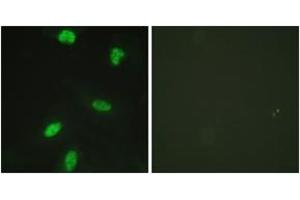 Immunofluorescence analysis of HeLa cells, using Retinoblastoma (Phospho-Thr821) Antibody. (Retinoblastoma Protein (Rb) 抗体  (pThr821))