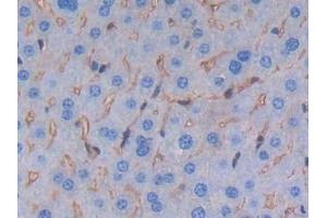 Detection of ALB in Mouse Liver Tissue using Polyclonal Antibody to Albumin (ALB) (Albumin 抗体)