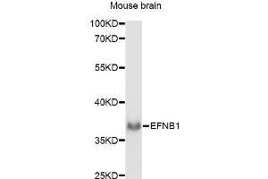 Western blot analysis of extracts of mouse brain, using EFNB1 antibody (ABIN6290364) at 1:1000 dilution. (Ephrin B1 抗体)