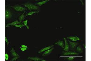 Immunofluorescence of purified MaxPab antibody to CDADC1 on HeLa cell. (CDADC1 抗体  (AA 1-514))