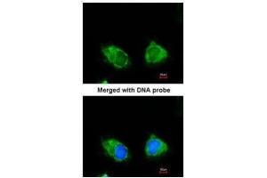 ICC/IF Image Immunofluorescence analysis of paraformaldehyde-fixed HeLa, using INPP1, antibody at 1:200 dilution. (INPP1 抗体)