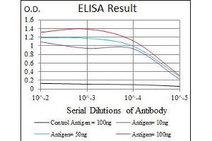 Black line: Control Antigen (100 ng), Purple line: Antigen(10 ng), Blue line: Antigen (50 ng), Red line: Antigen (100 ng), (Hexosaminidase A 抗体)