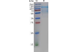 SDS-PAGE (SDS) image for delta Like Protein 3 (DLL3) (AA 27-490) protein (Fc Tag) (ABIN7092764)