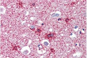 Immunohistochemistry (IHC) image for anti-Septin 2 (SEPT2) (N-Term) antibody (ABIN308439)
