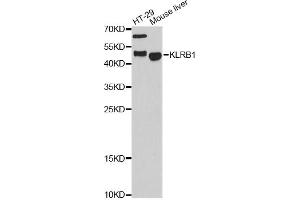 Western blot analysis of extracts of various cell lines, using KLRB1 antibody. (CD161 抗体)