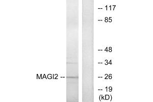 Western blot analysis of extracts from HT-29 cells, using MAGI2 antibody. (MAGI2 抗体  (Internal Region))