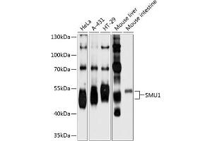 Western blot analysis of extracts of various cell lines, using SMU1 antibody  at 1:1000 dilution. (SMU1 抗体  (AA 1-220))