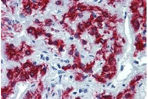 Human Adrenal: Formalin-Fixed, Paraffin-Embedded (FFPE) (VEZF1 抗体  (AA 288-337))