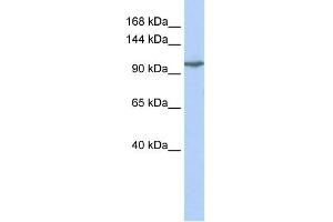 WB Suggested Anti-GRIK5 Antibody Titration:  0.