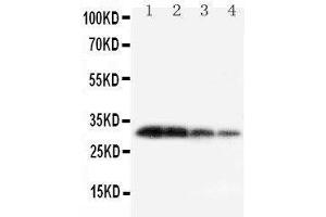 Lane 4: Recombinant Mouse KLK1 Protein 1.