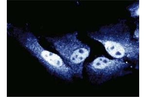 Immunofluorescent staining of HeLa cells. (CDC27 抗体  (AA 145-343))