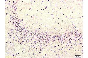 Immunohistochemistry (Paraffin-embedded Sections) (IHC (p)) image for anti-Prostaglandin-Endoperoxide Synthase 2 (Prostaglandin G/H Synthase and Cyclooxygenase) (PTGS2) (AA 501-604) antibody (ABIN672471)