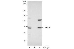 IP Image Immunoprecipitation of RPA70 protein from 293T whole cell extracts using 5 μg of RPA70 antibody [C1C3], Western blot analysis was performed using RPA70 antibody [C1C3], EasyBlot anti-Rabbit IgG  was used as a secondary reagent. (RPA1 抗体  (C-Term))