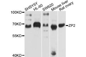 Western blot analysis of extracts of various cell lines, using ZP2 antibody. (ZP2 抗体)