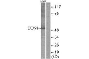 Western blot analysis of extracts from K562 cells, treated with Starvation 24h, using p62 Dok (Ab-398) Antibody. (DOK1 抗体  (AA 365-414))