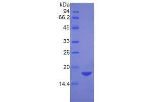 SDS-PAGE of Protein Standard from the Kit (Highly purified E. (NPM1 ELISA 试剂盒)