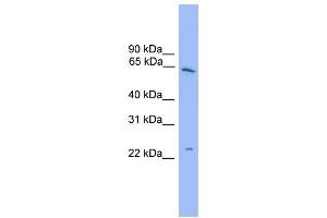 Western Blotting (WB) image for anti-Heat Shock 22kDa Protein 8 (HSPB8) (Middle Region) antibody (ABIN2774096)