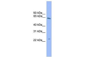 WB Suggested Anti-HSPB8  Antibody Titration: 0. (HSPB8 抗体  (Middle Region))