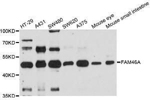 Western blot analysis of extracts of various cell lines, using FAM46A antibody. (FAM46A 抗体)