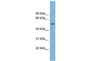 WB Suggested Anti-CHST1 Antibody Titration: 0. (CHST1 抗体  (Middle Region))