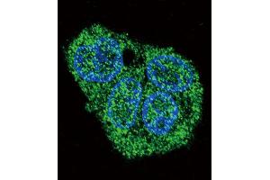 Immunofluorescence (IF) image for anti-Surfactant Protein C (SFTPC) antibody (ABIN2997467) (Surfactant Protein C 抗体)