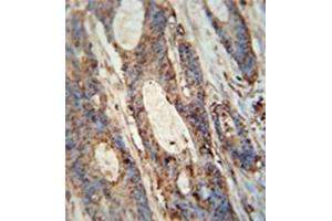 anti-Family with Sequence Similarity 46, Member A (FAM46A) (AA 96-125), (Middle Region) antibody