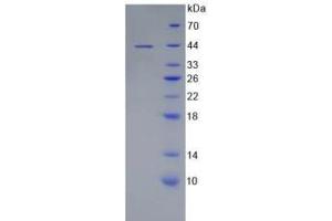 SDS-PAGE analysis of Human MAP2 Protein. (MAP2 蛋白)