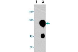 Western blot analysis of ROR2 (arrow) using ROR2 polyclonal antibody . (ROR2 抗体  (N-Term))