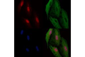 ABIN6260726 and ABIN6266946 staining  cells by IF/ICC. (CDKL4 抗体  (Internal Region))