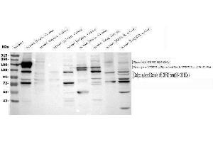 Western blot analysis of VEGF Receptor 2 using anti-VEGF Receptor 2 antibody (ABIN5693262). (VEGFR2/CD309 抗体  (AA 20-244))