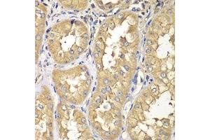 Immunohistochemistry of paraffin-embedded human kidney using RAB5C antibody. (Rab5c 抗体  (AA 1-216))
