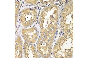 Immunohistochemistry of paraffin-embedded human kidney using RAB5C antibody. (Rab5c 抗体  (AA 1-216))