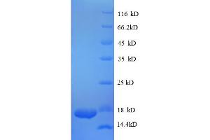 SDS-PAGE (SDS) image for Transforming Growth Factor, beta 1 (TGFB1) (AA 281-390), (partial) protein (His tag) (ABIN5712518) (TGFB1 Protein (AA 281-390, partial) (His tag))