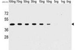 Western Blotting (WB) image for anti-Tyr/ser Protein Phosphatase antibody (ABIN2995280) (Tyr/ser Protein Phosphatase 抗体)