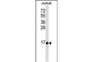 Western blot analysis in Jurkat cell line lysates (35ug/lane). (Tachykinin 3 抗体  (AA 54-83))