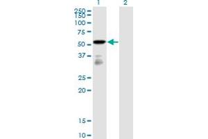 Western Blot analysis of FGFR1OP expression in transfected 293T cell line by FGFR1OP monoclonal antibody (M01), clone 2B1. (FGFR1OP 抗体  (AA 1-379))