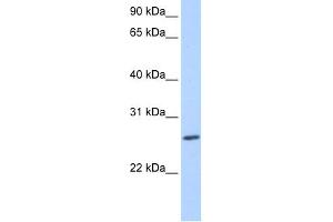WB Suggested Anti-ZNF664 Antibody Titration:  0.