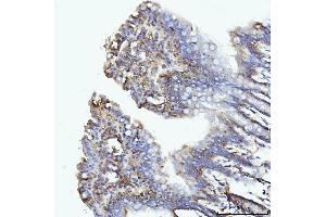 IHC analysis of GLUL using anti-GLUL antibody (ABIN7602403).